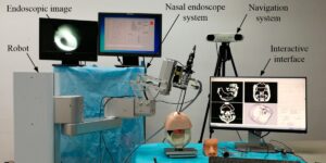 Endoscopes: Versatile & Efficient Assistants